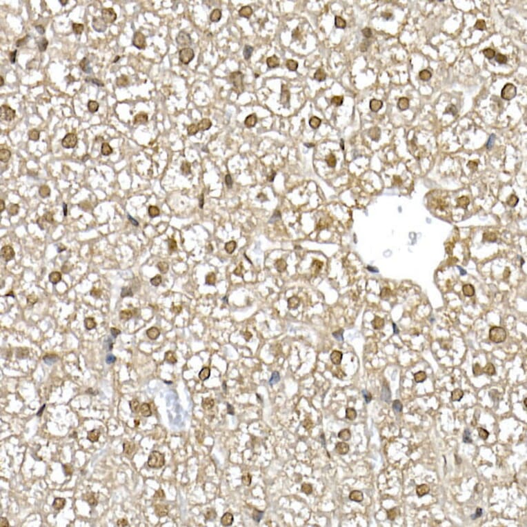 Immunohistochemistry - Anti-PTEN Antibody (A81023) - Antibodies.com