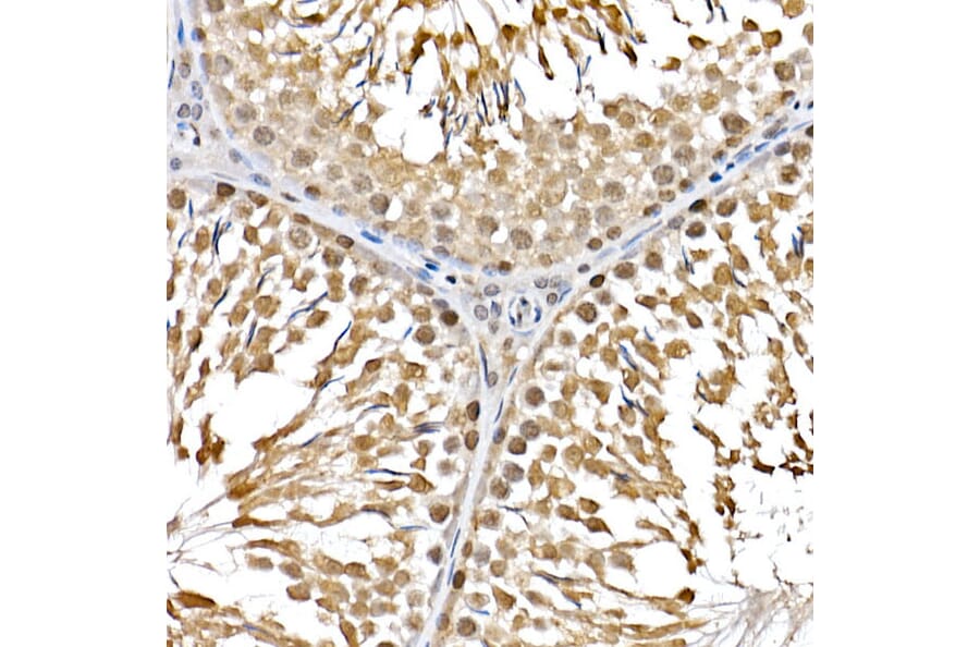 Immunohistochemistry - Anti-PTEN Antibody (A81023) - Antibodies.com