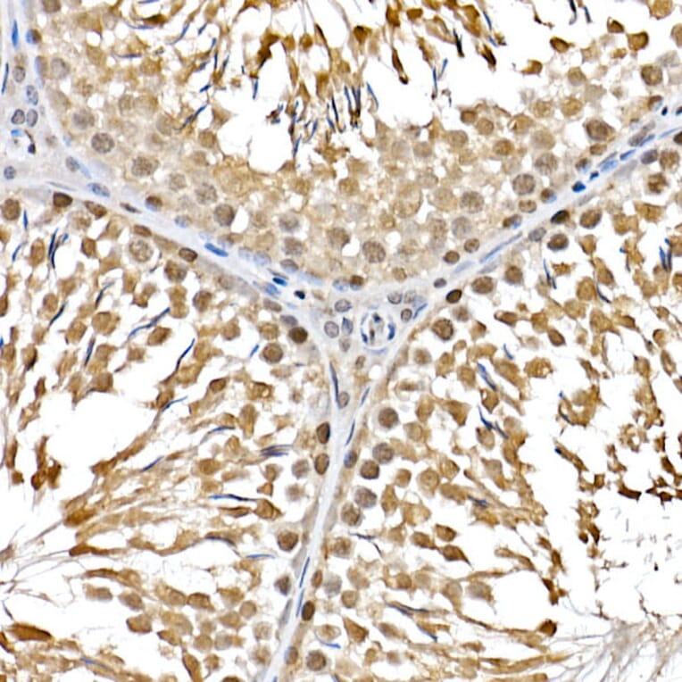 Immunohistochemistry - Anti-PTEN Antibody (A81023) - Antibodies.com