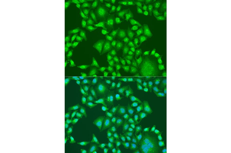 Immunofluorescence - Anti-PTEN Antibody (A81023) - Antibodies.com