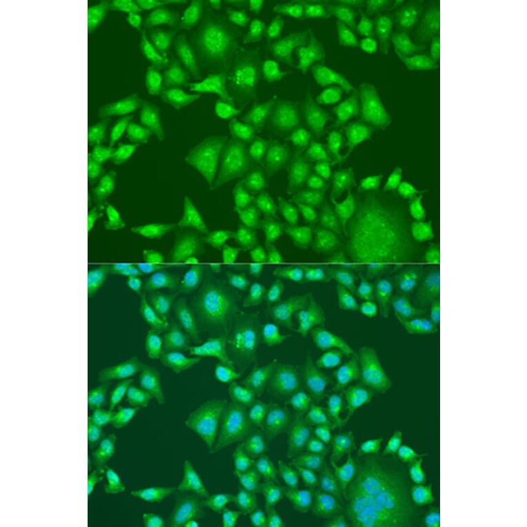 Immunofluorescence - Anti-PTEN Antibody (A81023) - Antibodies.com