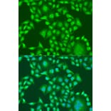 Immunofluorescence - Anti-PTEN Antibody (A81023) - Antibodies.com