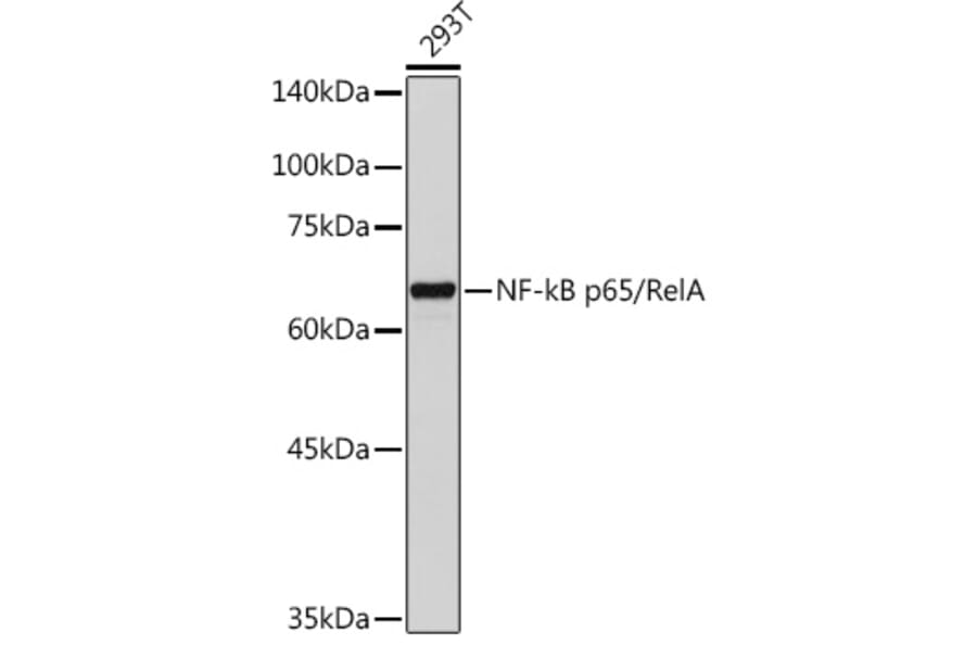 Western Blot - Anti-NF-kB p65 Antibody (A81024) - Antibodies.com