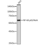 Western Blot - Anti-NF-kB p65 Antibody (A81024) - Antibodies.com