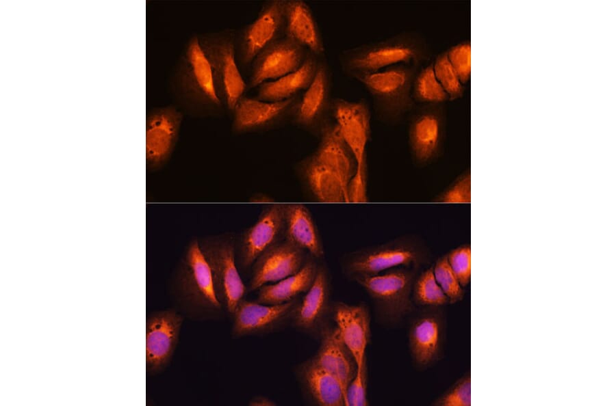 Immunofluorescence - Anti-NF-kB p65 Antibody (A81024) - Antibodies.com