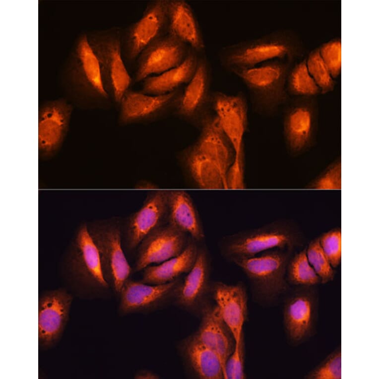 Immunofluorescence - Anti-NF-kB p65 Antibody (A81024) - Antibodies.com