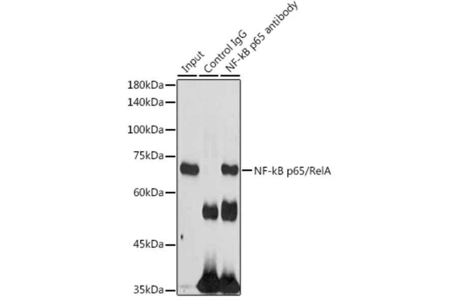 Western Blot - Anti-NF-kB p65 Antibody (A81024) - Antibodies.com