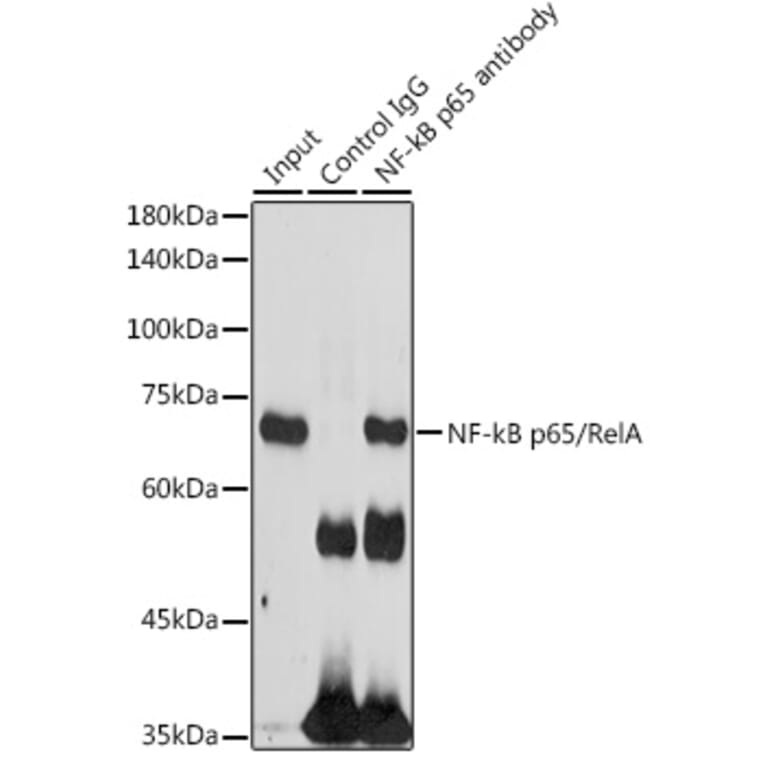 Western Blot - Anti-NF-kB p65 Antibody (A81024) - Antibodies.com