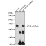 Western Blot - Anti-NF-kB p65 Antibody (A81024) - Antibodies.com