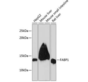 Western Blot - Anti-liver FABP Antibody [ARC0545] (A81027) - Antibodies.com