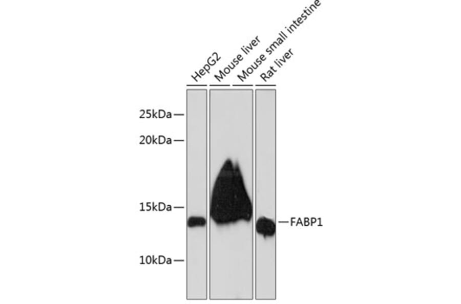 Western Blot - Anti-liver FABP Antibody [ARC0545] (A81027) - Antibodies.com