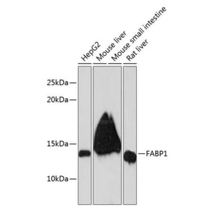 Western Blot - Anti-liver FABP Antibody [ARC0545] (A81027) - Antibodies.com