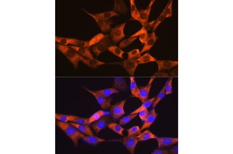 Immunofluorescence - Anti-liver FABP Antibody [ARC0545] (A81027) - Antibodies.com