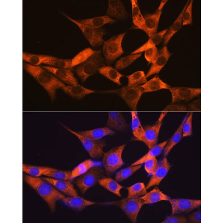 Immunofluorescence - Anti-liver FABP Antibody [ARC0545] (A81027) - Antibodies.com