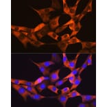 Immunofluorescence - Anti-liver FABP Antibody [ARC0545] (A81027) - Antibodies.com