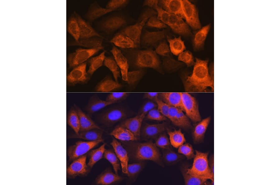 Immunofluorescence - Anti-liver FABP Antibody [ARC0545] (A81027) - Antibodies.com