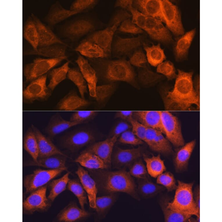 Immunofluorescence - Anti-liver FABP Antibody [ARC0545] (A81027) - Antibodies.com