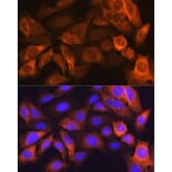 Immunofluorescence - Anti-liver FABP Antibody [ARC0545] (A81027) - Antibodies.com