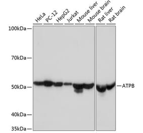 Western Blot - Anti-ATPB Antibody [ARC53533] (A81028) - Antibodies.com