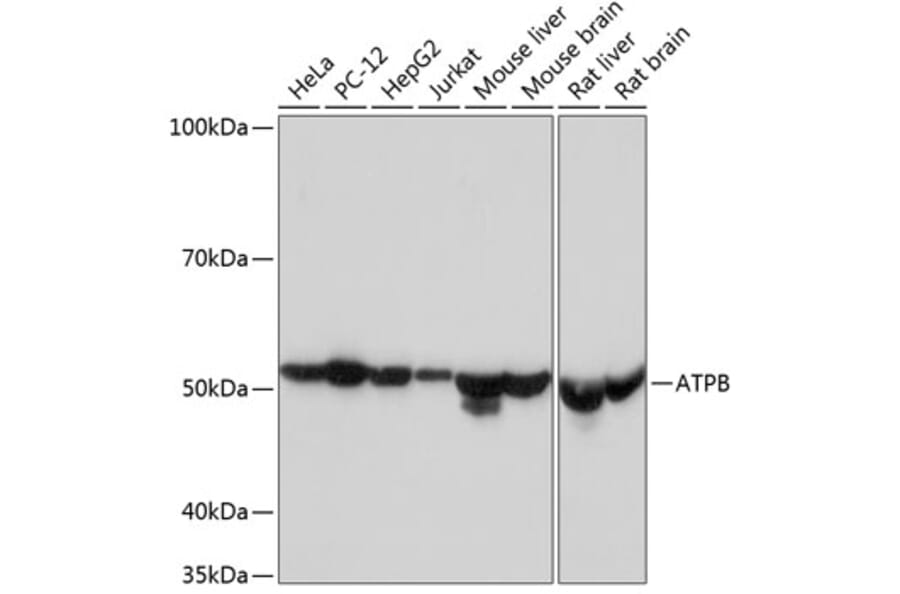 Western Blot - Anti-ATPB Antibody [ARC53533] (A81028) - Antibodies.com