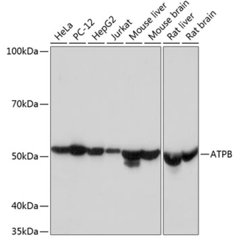 Western Blot - Anti-ATPB Antibody [ARC53533] (A81028) - Antibodies.com