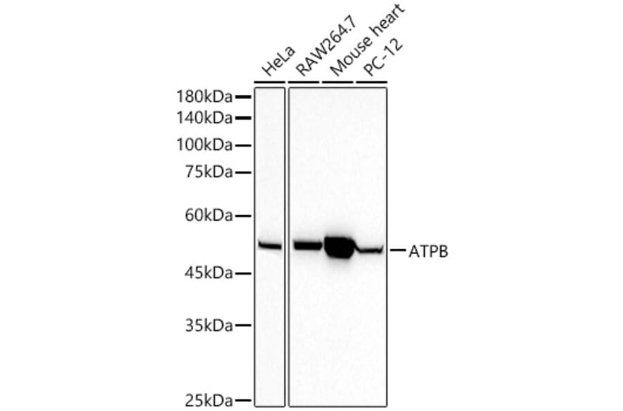 Western Blot - Anti-ATPB Antibody [ARC53533] (A81028) - Antibodies.com