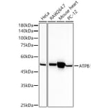 Western Blot - Anti-ATPB Antibody [ARC53533] (A81028) - Antibodies.com