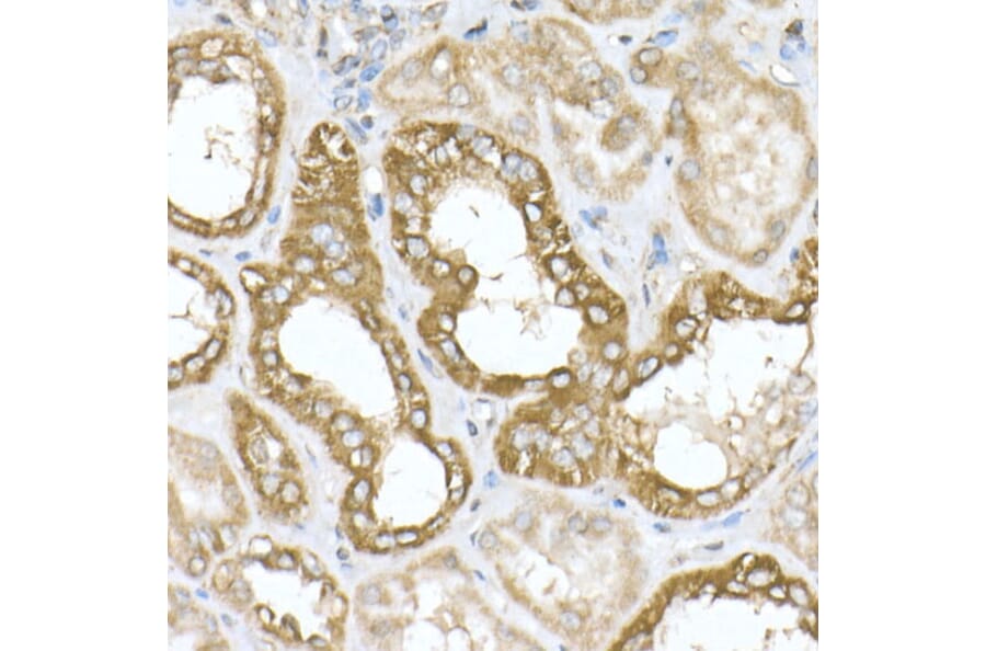 Immunohistochemistry - Anti-ATPB Antibody [ARC53533] (A81028) - Antibodies.com