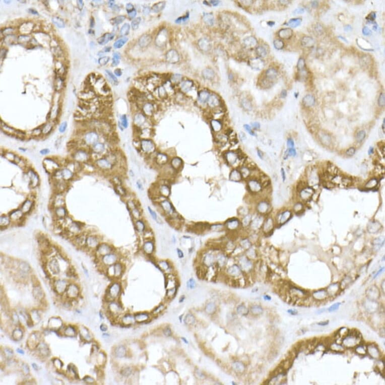 Immunohistochemistry - Anti-ATPB Antibody [ARC53533] (A81028) - Antibodies.com