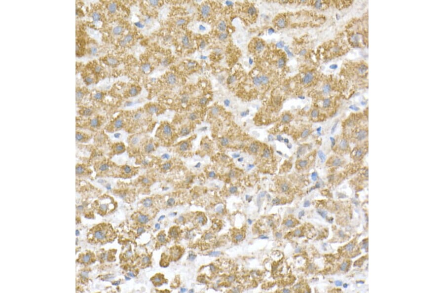 Immunohistochemistry - Anti-ATPB Antibody [ARC53533] (A81028) - Antibodies.com