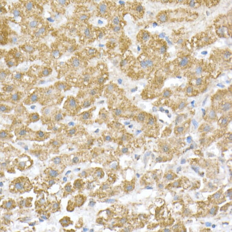 Immunohistochemistry - Anti-ATPB Antibody [ARC53533] (A81028) - Antibodies.com