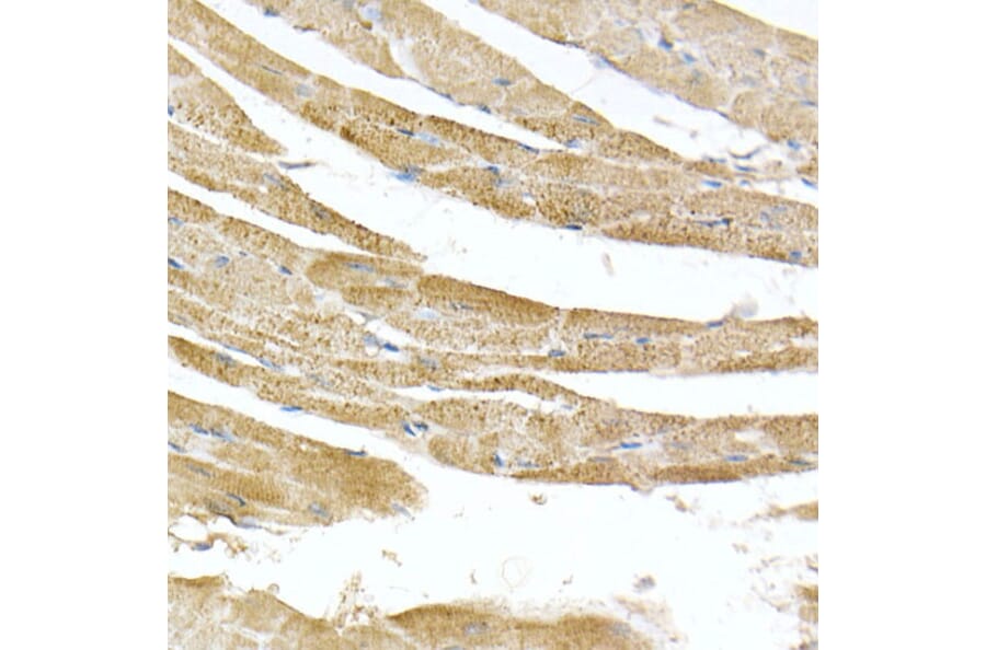 Immunohistochemistry - Anti-ATPB Antibody [ARC53533] (A81028) - Antibodies.com