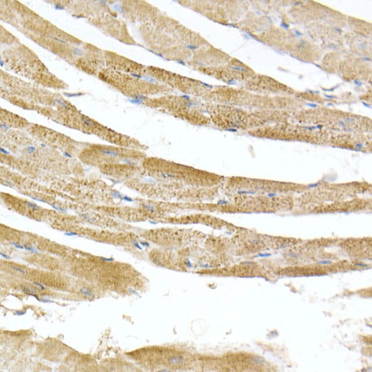 Immunohistochemistry - Anti-ATPB Antibody [ARC53533] (A81028) - Antibodies.com