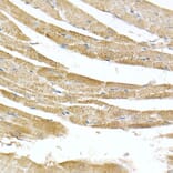 Immunohistochemistry - Anti-ATPB Antibody [ARC53533] (A81028) - Antibodies.com