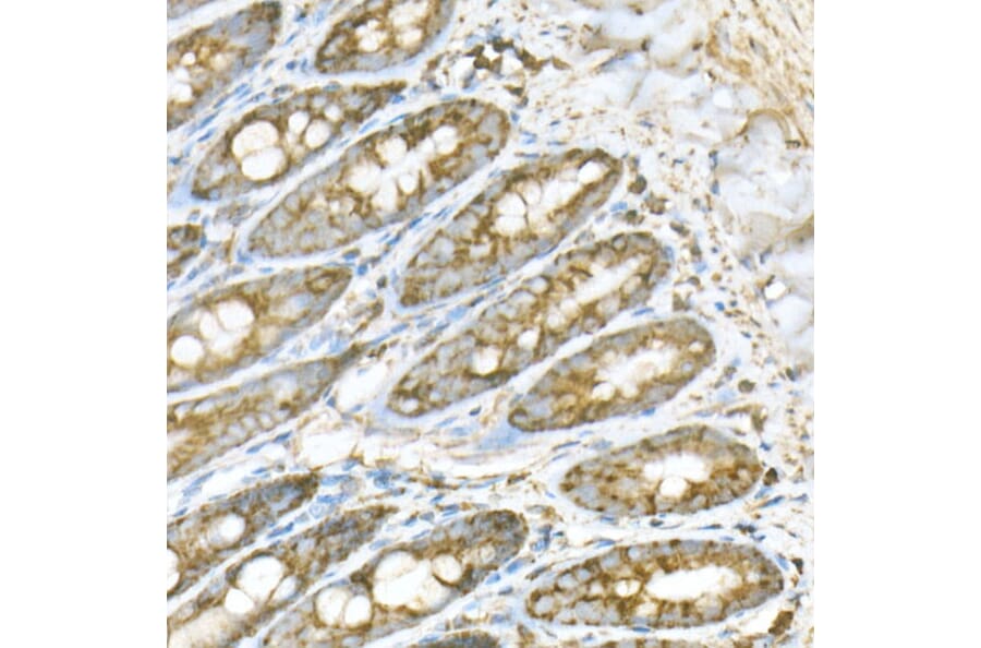 Immunohistochemistry - Anti-ATPB Antibody [ARC53533] (A81028) - Antibodies.com