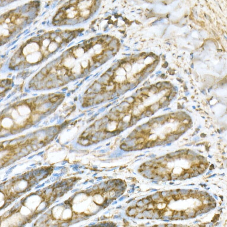 Immunohistochemistry - Anti-ATPB Antibody [ARC53533] (A81028) - Antibodies.com