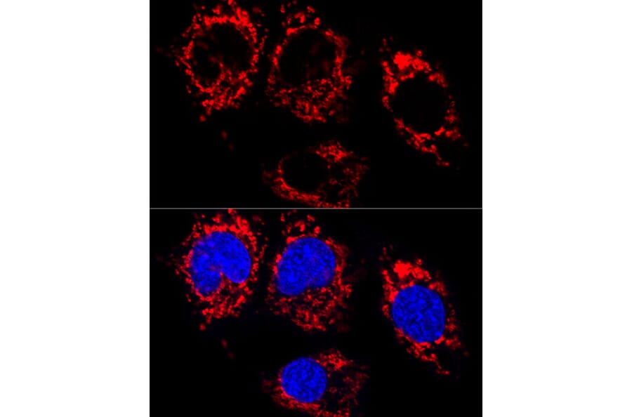 Immunofluorescence - Anti-ATPB Antibody [ARC53533] (A81028) - Antibodies.com