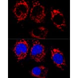 Immunofluorescence - Anti-ATPB Antibody [ARC53533] (A81028) - Antibodies.com