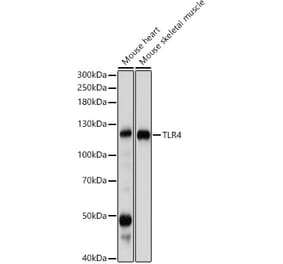 Western Blot - Anti-TLR4 Antibody (A81029) - Antibodies.com