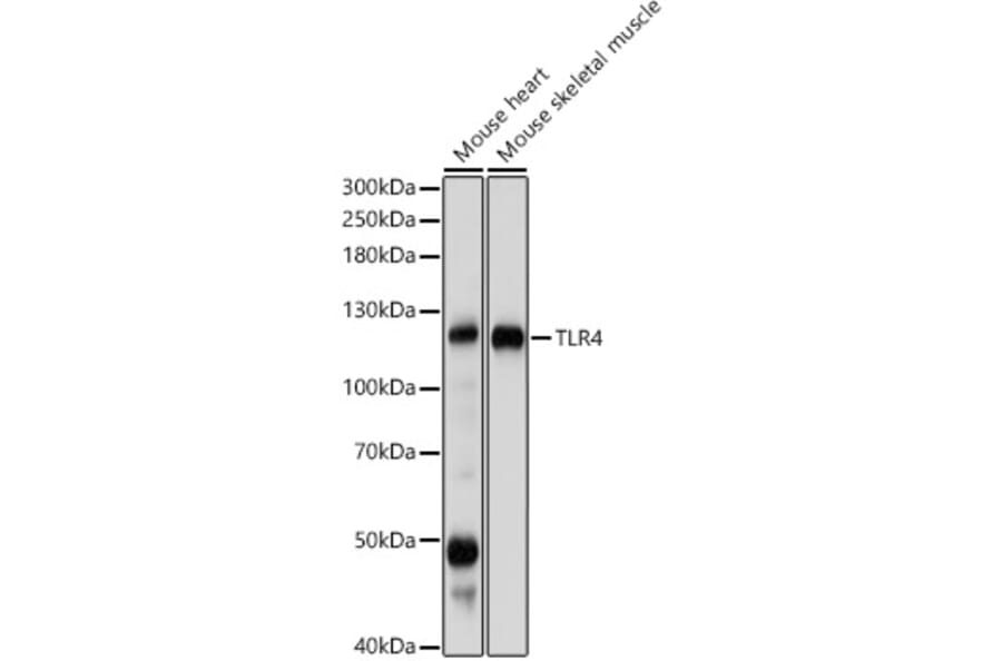Western Blot - Anti-TLR4 Antibody (A81029) - Antibodies.com