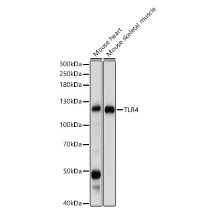 Western Blot - Anti-TLR4 Antibody (A81029) - Antibodies.com