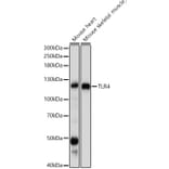 Western Blot - Anti-TLR4 Antibody (A81029) - Antibodies.com
