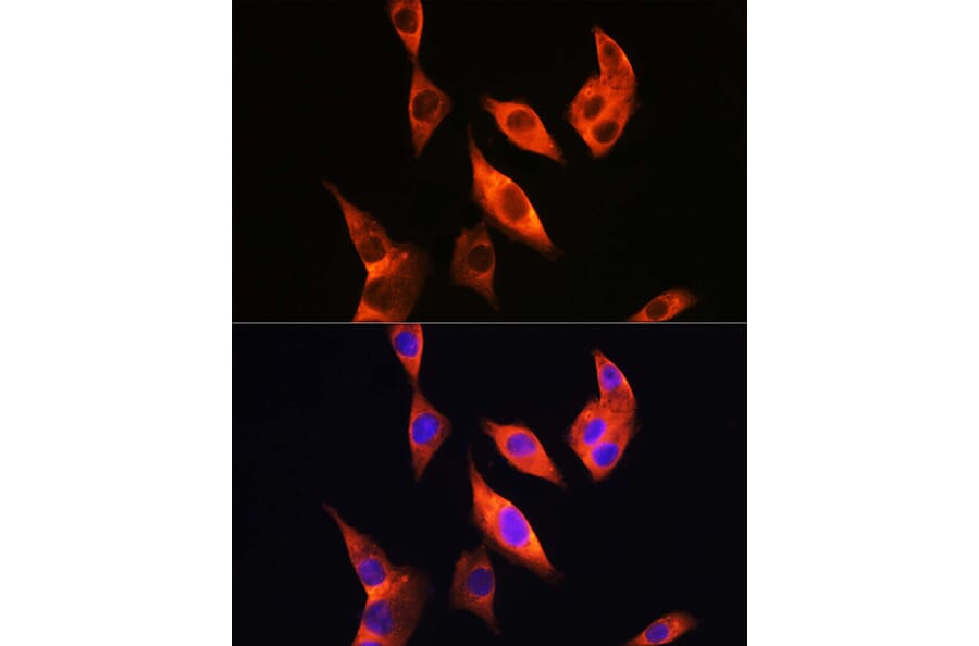 Immunofluorescence - Anti-TLR4 Antibody (A81029) - Antibodies.com