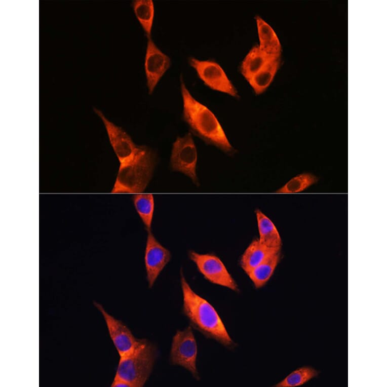 Immunofluorescence - Anti-TLR4 Antibody (A81029) - Antibodies.com