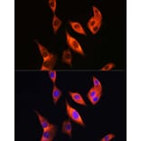 Immunofluorescence - Anti-TLR4 Antibody (A81029) - Antibodies.com