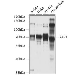 Western Blot - Anti-YAP1 Antibody (A81030) - Antibodies.com