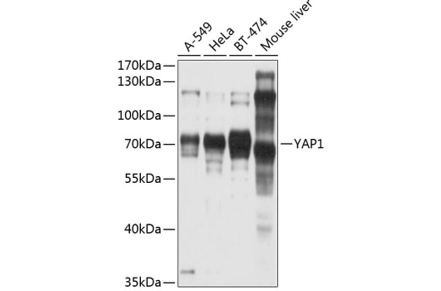 Western Blot - Anti-YAP1 Antibody (A81030) - Antibodies.com