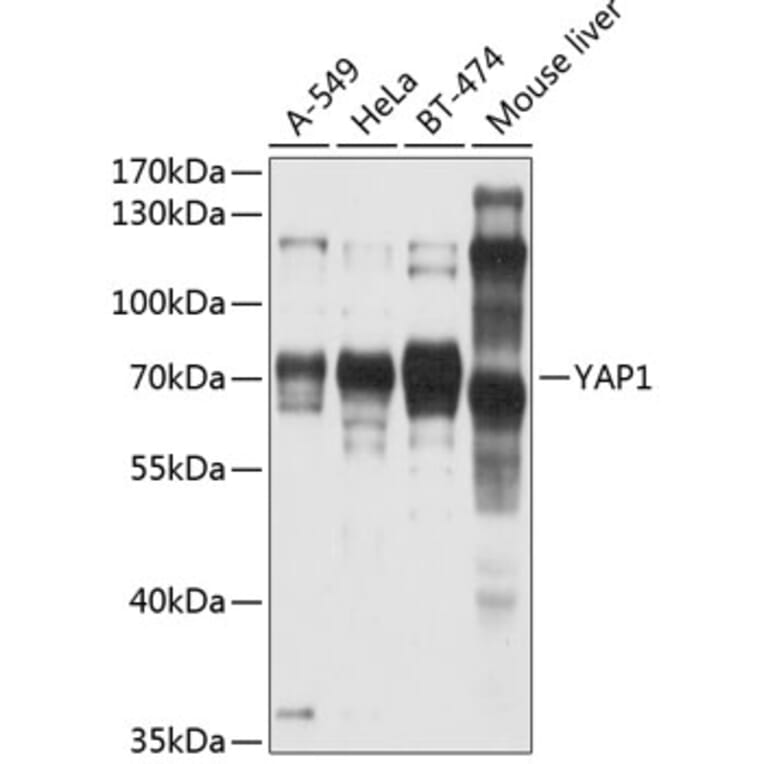 Western Blot - Anti-YAP1 Antibody (A81030) - Antibodies.com