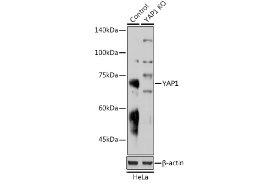 Western Blot - Anti-YAP1 Antibody (A81030) - Antibodies.com