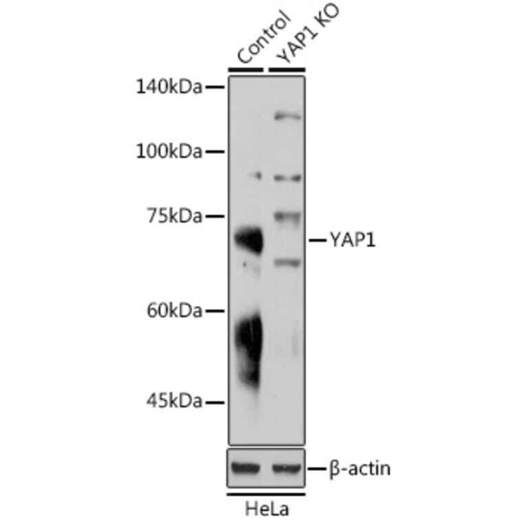 Western Blot - Anti-YAP1 Antibody (A81030) - Antibodies.com